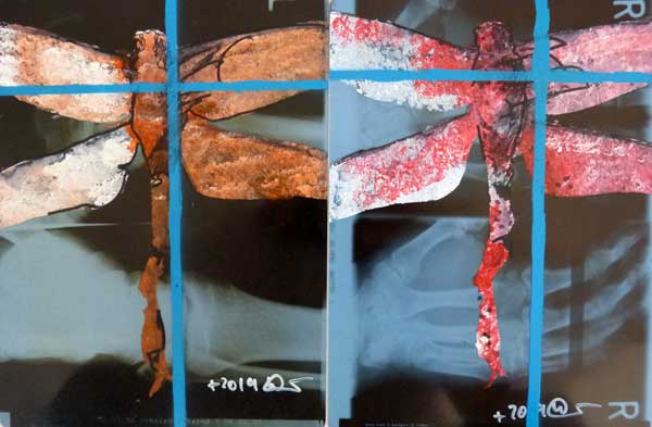 Libellen und Kröte - Mischtechnik auf Papier und z.T. auf Röntgenbildern